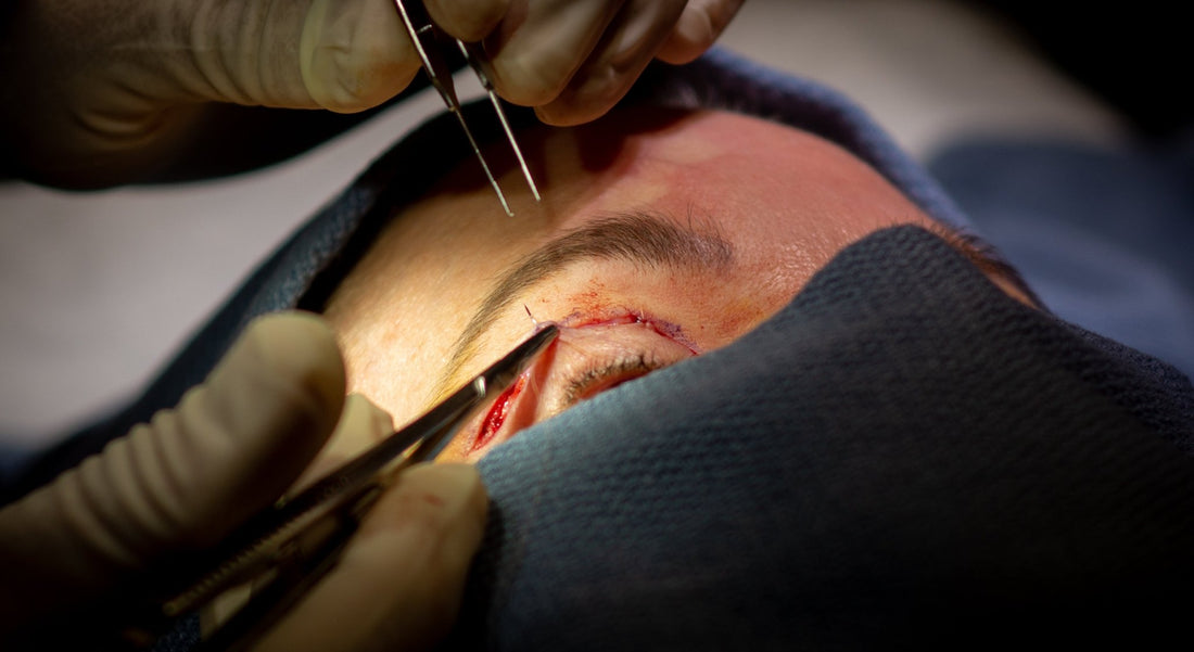 Chin Up! Atlanta Loves Facial Plastic Surgery Procedures - Broadcast Atlanta